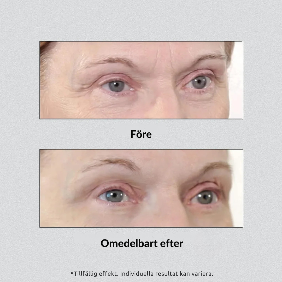 Instant Eye Lift Pro