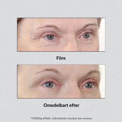 Instant Eye Lift Pro