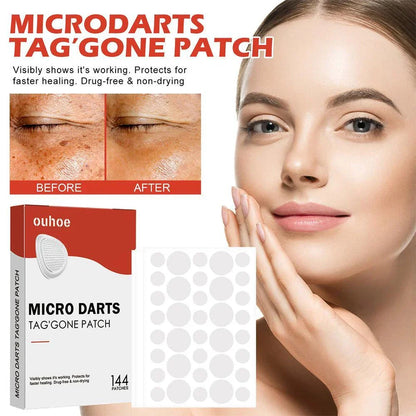 DermaDot™ MicroDarts – Smärtfri borttagning av hudflikar